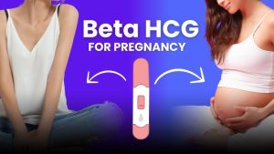 b-hCG Test Price in USA
