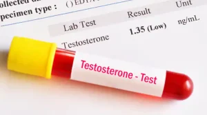 Testosterone Test Price in USA 2025 – Cost, Guide & Booking Info
